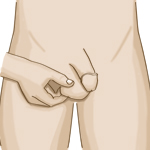 How To Perform a Testicular Exam\JPG\Testicular 6.jpg