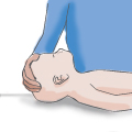\How to Images\CPR\cpr 2a.jpg