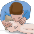 \How to Images\CPR\cpr 2b.jpg