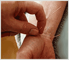Image for wrist acupuncture